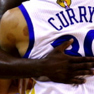 Suction Cup Marks on Steph Curry's Left shoulder